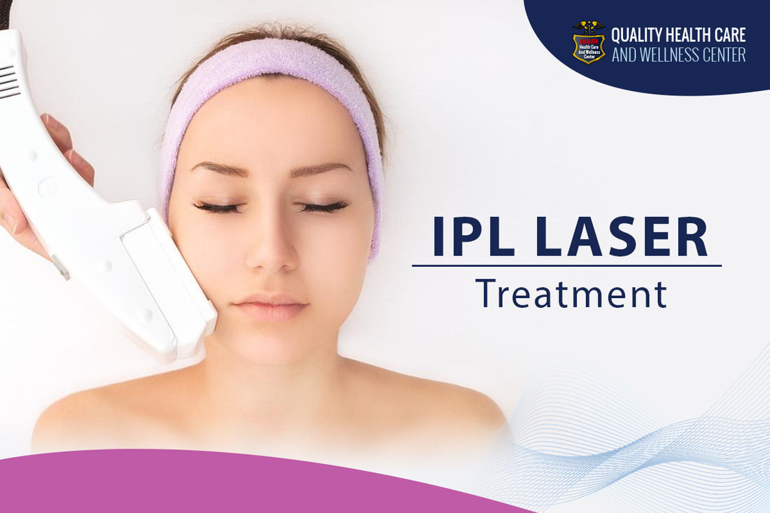 Understanding The Importance Of IPL Laser Treatment